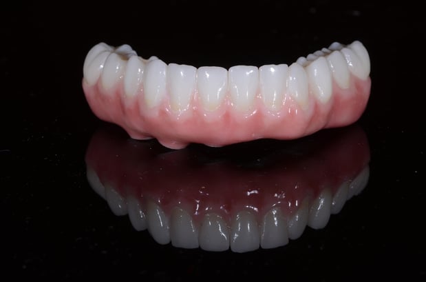 Images Nashville Wisdom Teeth and Implant Solutions