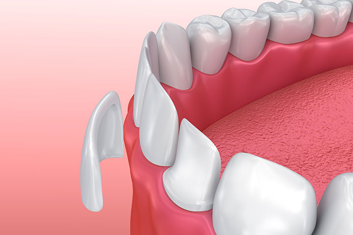 Images Clínica Dental Indenta