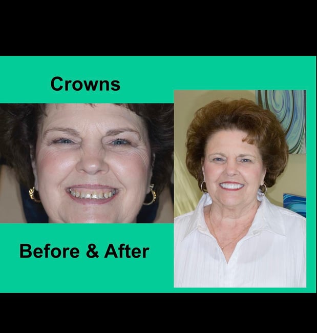 Images Decatur Smiles