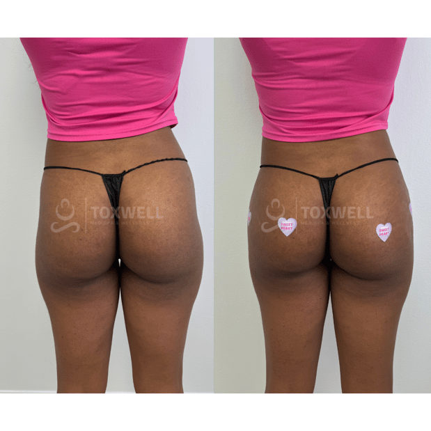 Images Toxwell Med Spa and Wellness