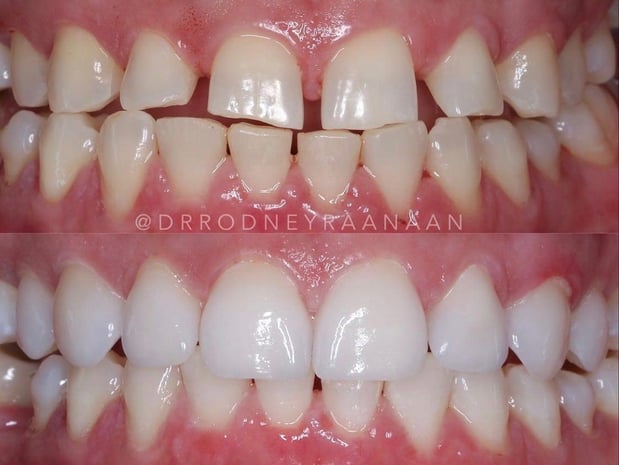 Images Dr. Rodney Raanan