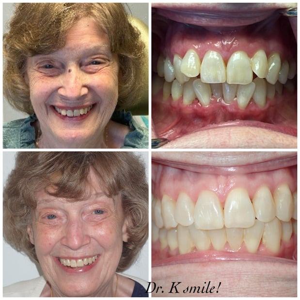 Images Reston Heights Dental