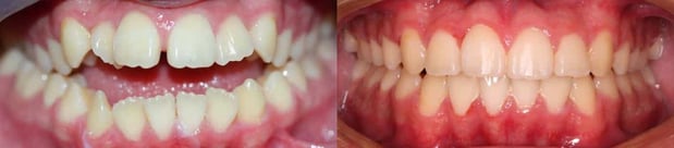 Images TLC Pediatric Dentistry and Orthodontics