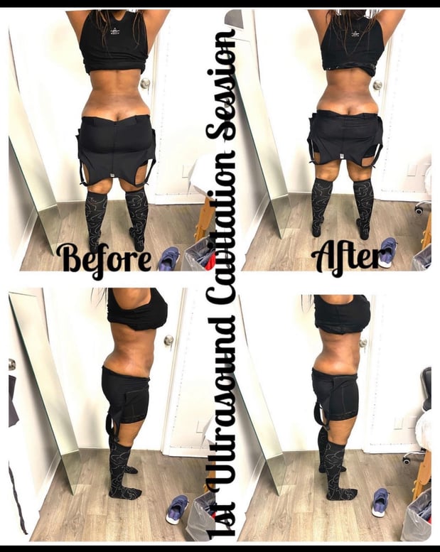 Images Queen Divas Body Sculpting