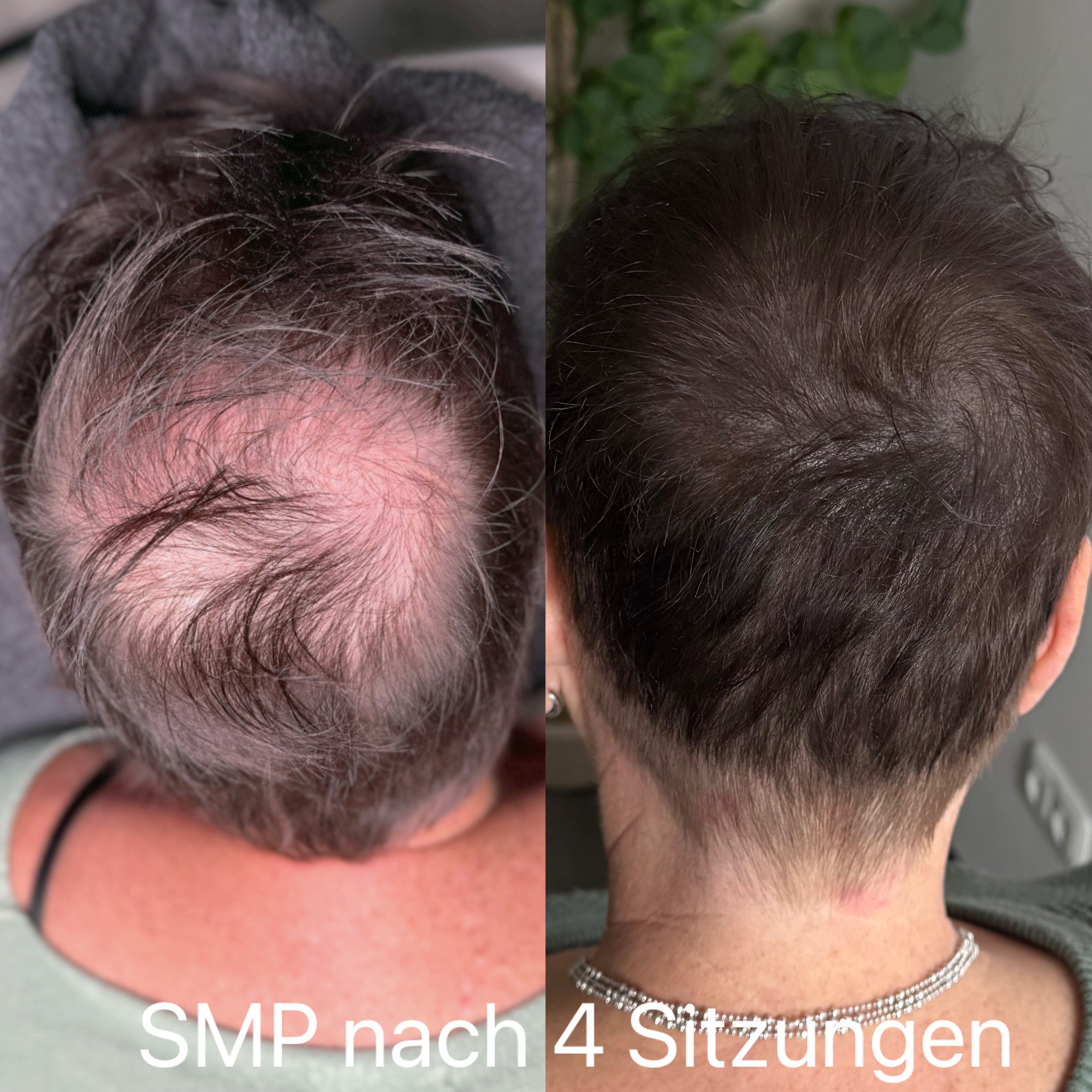 Bild 39 von Nadel Stadl Cosmetics - Permanent Makeup, Kosmetikstudio