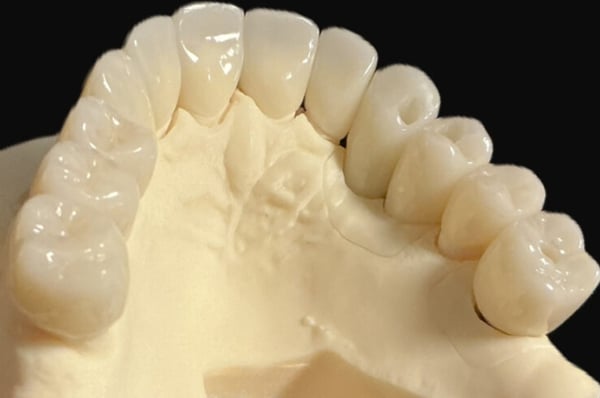 Bilder Dental Studio Meniten Fechner & Josef Böhm GbR