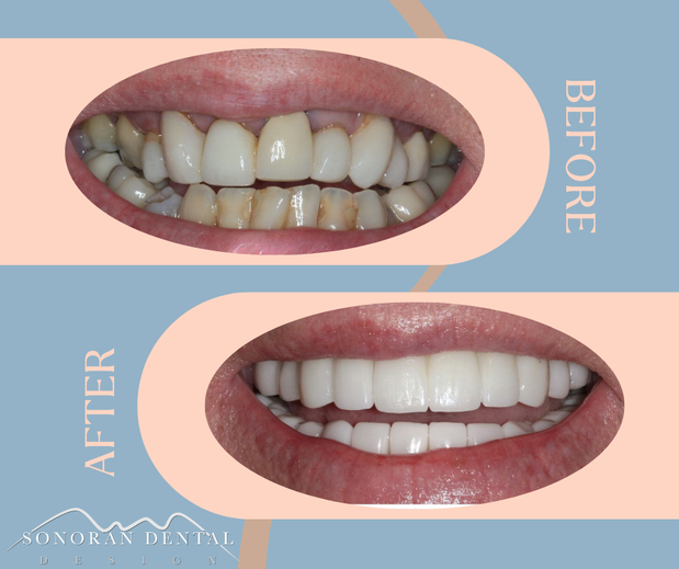 Images Sonoran Dental Design