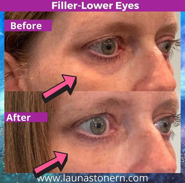 Images Launa Stone, R.N.