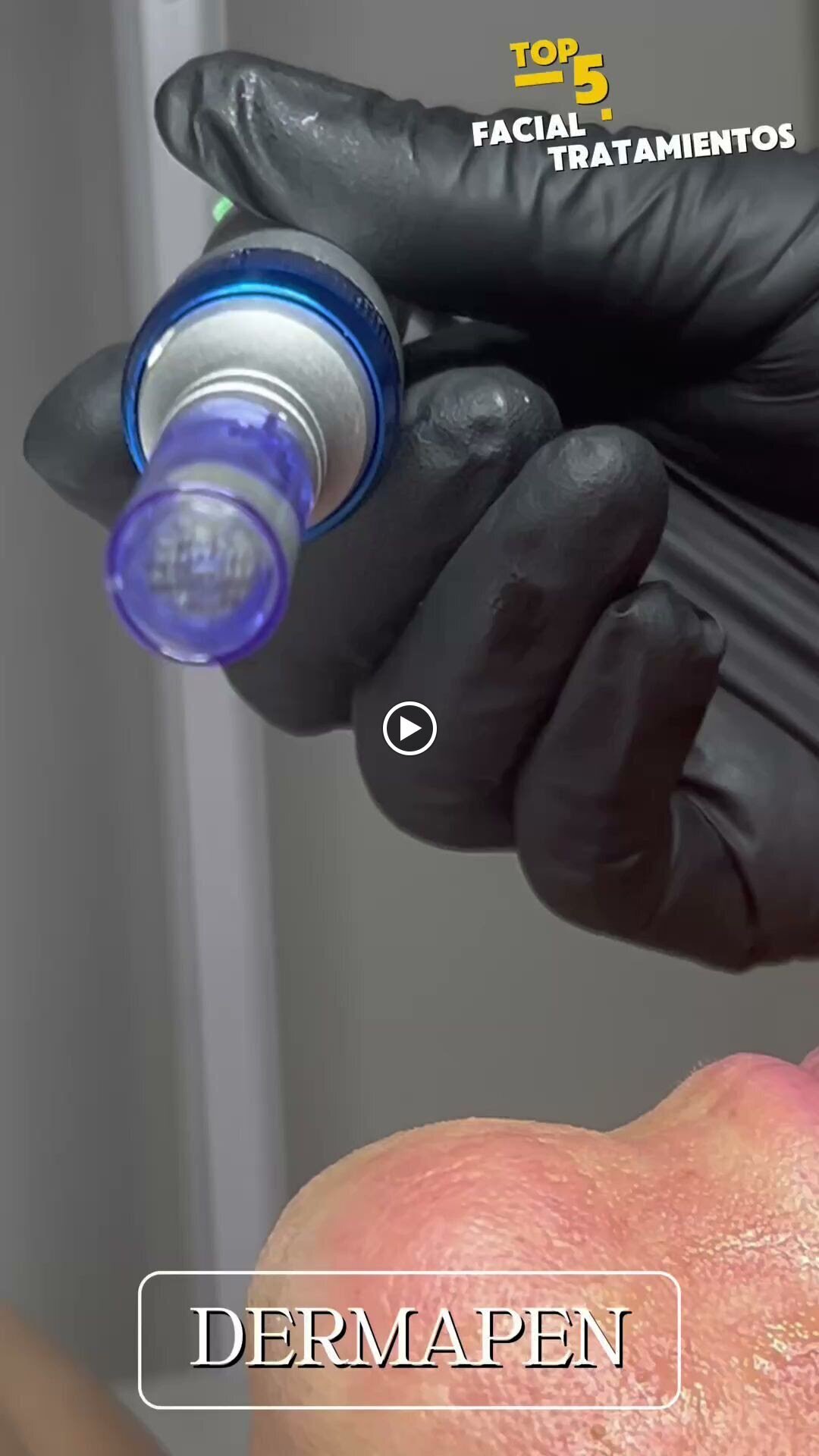 Images Diodolaser Madrid