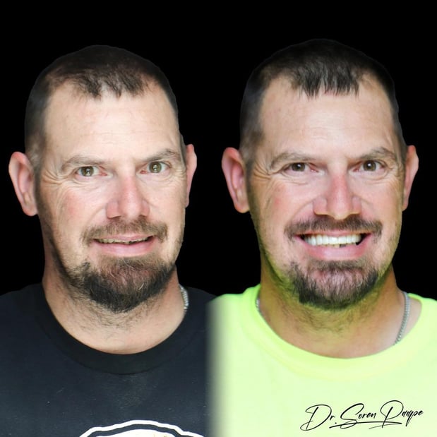 Images Smile Now Denver Dentures and Implants