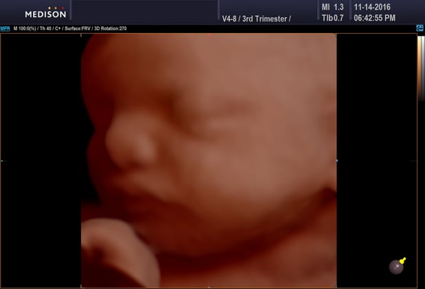 Images Heavenly 3D 4D Ultrasounds