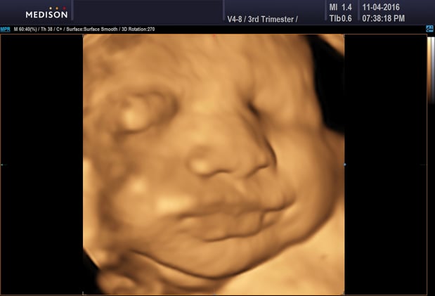 Images Heavenly 3D 4D Ultrasounds