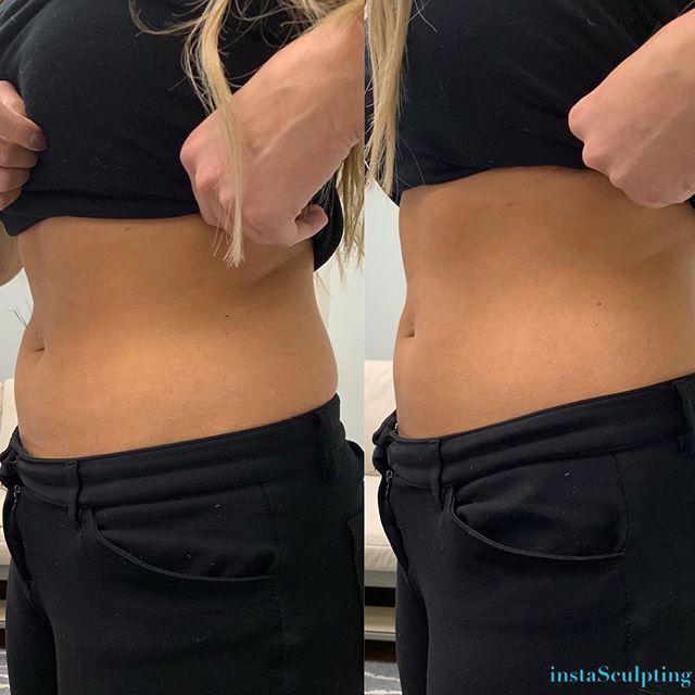 Images InstaSculpting Body Contour Center