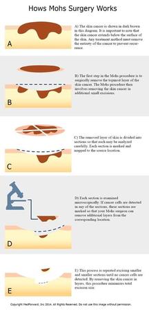 Images Lady Lake Dermatology & Mohs Surgery, The Villages