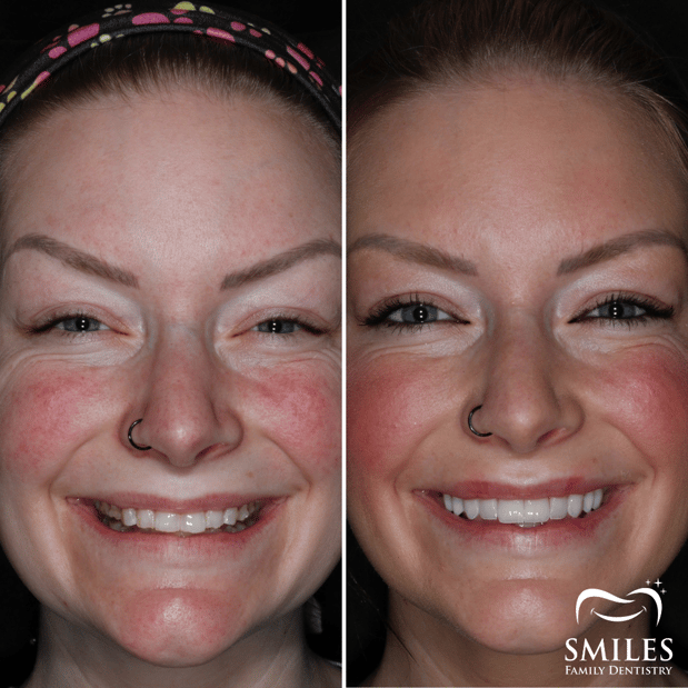 Images Brunswick Smiles Family Dentistry Implant, Oral Surgery, and Cosmetic Dentist