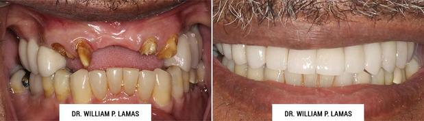 Images William P. Lamas, DMD - Periodontics & Dental Implants