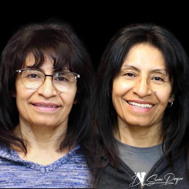 Images Smile Now Denver Dentures and Implants