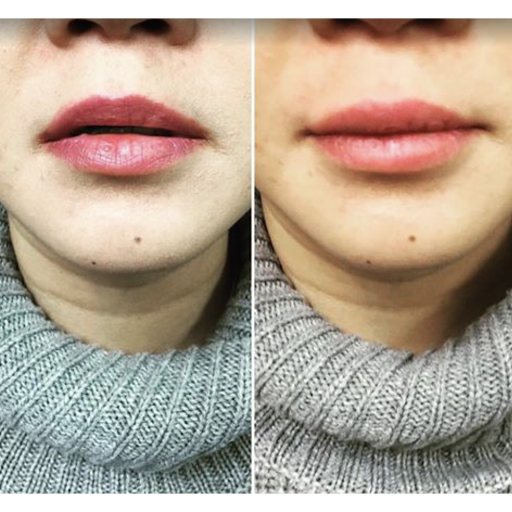 Dr Hani Sinno Chirurgien Esthétique | Plastic Surgeon | Laval