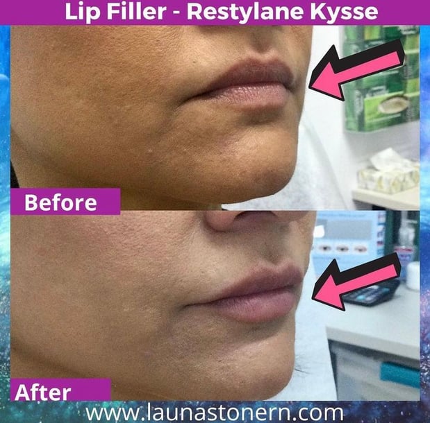 Images Launa Stone, R.N.