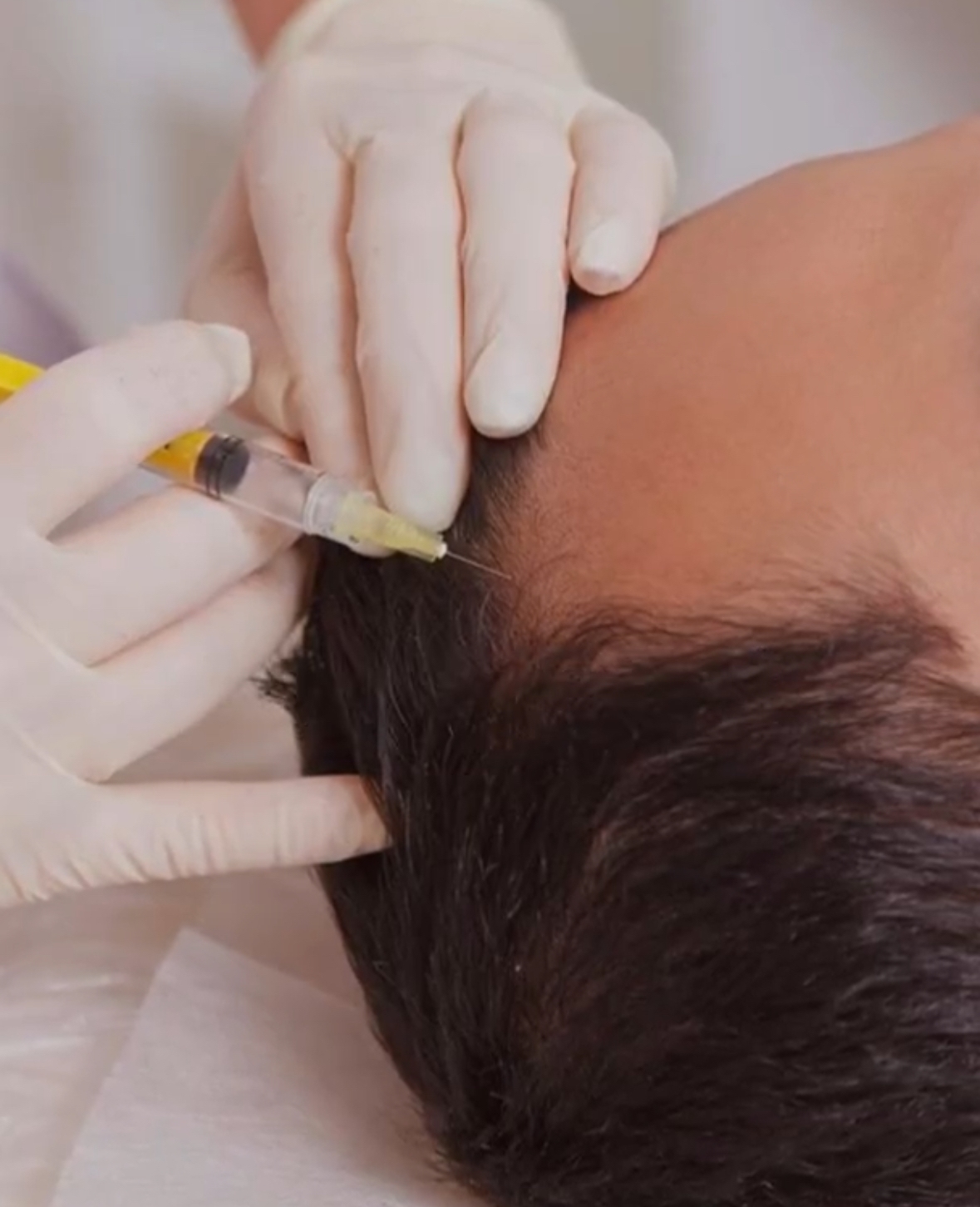 Images Skin Prick - Facial, PRP, Microneedling, Botox Toronto