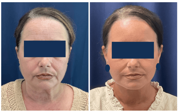 Images Columbia Aesthetic Plastic Surgery