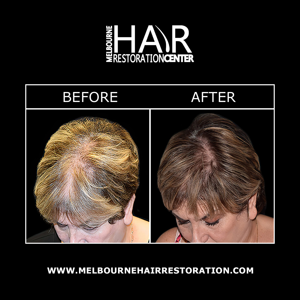 Melbourne Hair Restoration Center Image