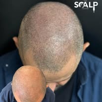 Images The Scalp Master