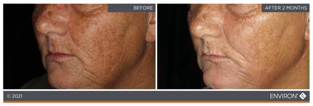 Images Celtic Spa & Laser Services