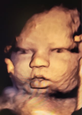 Images Love At First Sight 3D/4D Ultrasound Imaging Studio, LLC