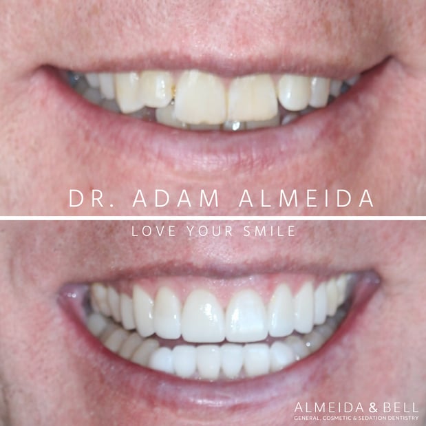 Images Almeida & Bell Dental Lone Tree - General, Cosmetic, and Implant Dentistry