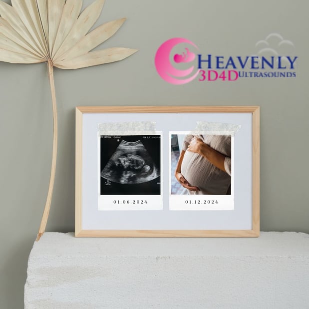 Images Heavenly 3D 4D Ultrasounds-Upland