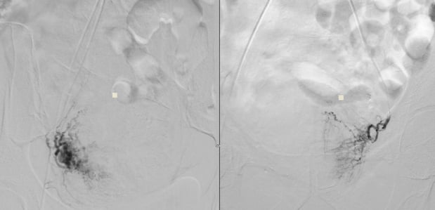 Images Swift Vein and Vascular Treatment Center | Interventional Radiologist | Vein Treatment