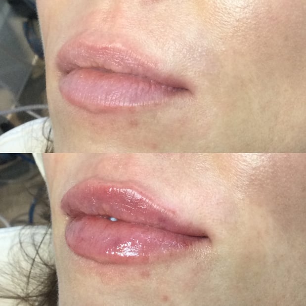 Images BCRN Aesthetics MedSpa