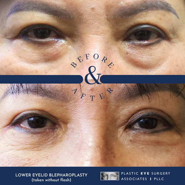 Images Plastic Eye Surgery Associates, PLLC