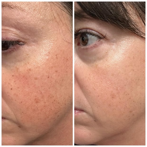 Images RAVE Spa & Clinic
