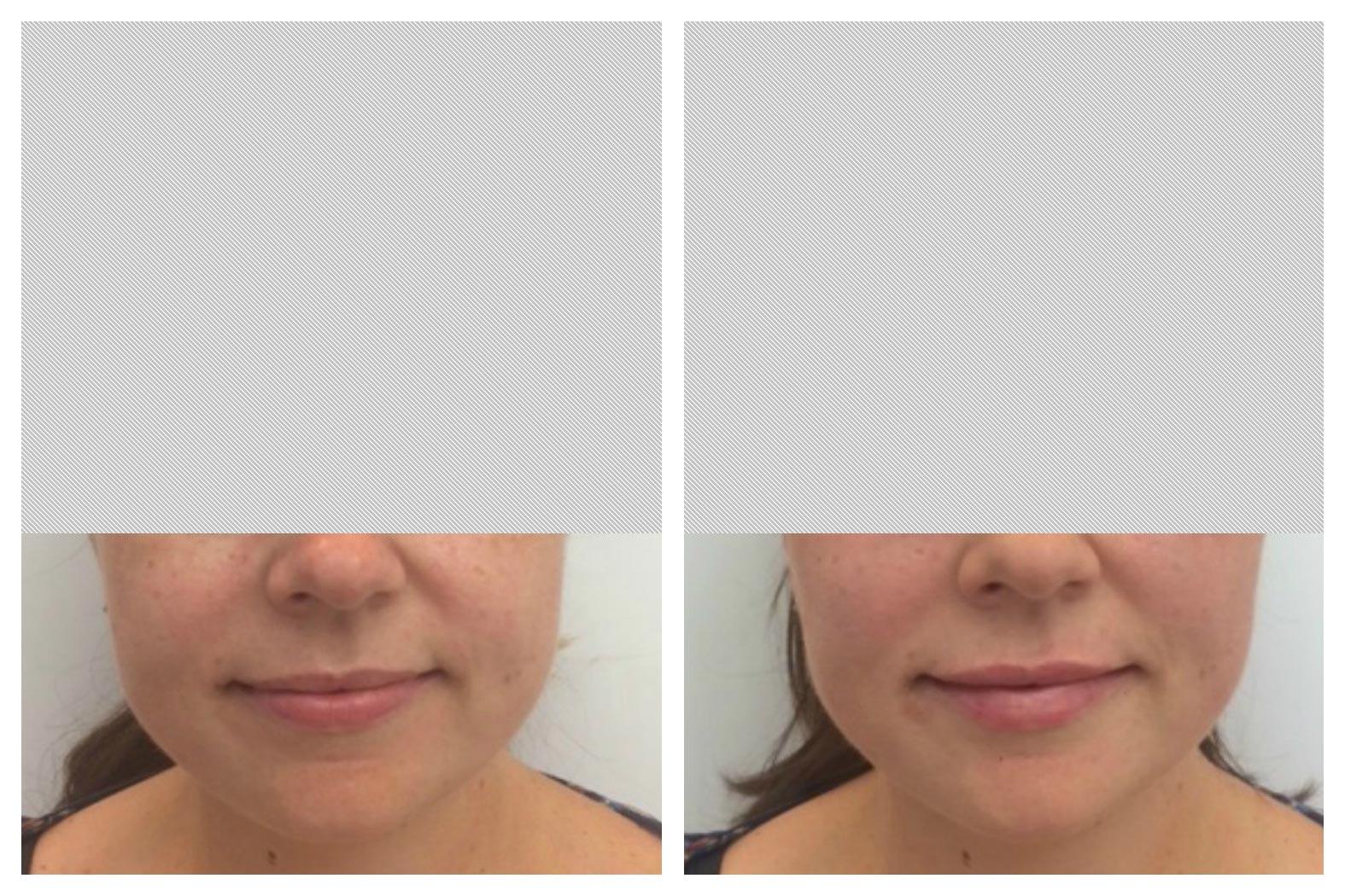Images About Face Medical Aesthetics - Richmond