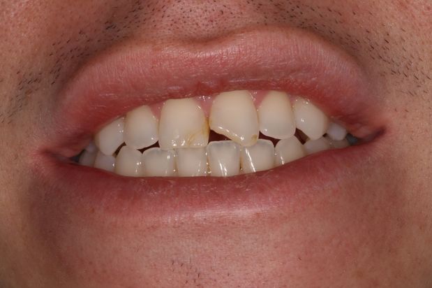 Images Aaron A. Leishman DMD, PA