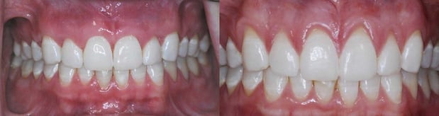 Images Mountainview Periodontics