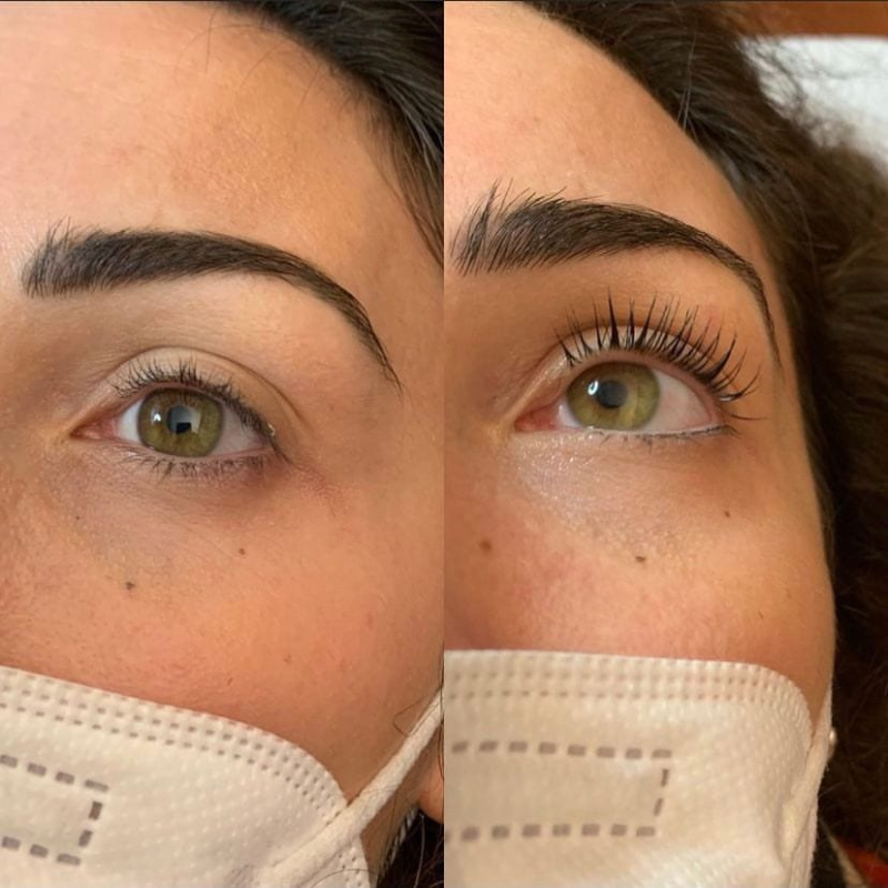 Images Garra Rufa Beach