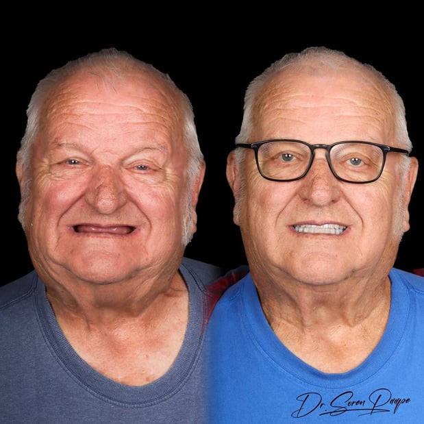 Images Smile Now Denver Dentures and Implants