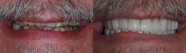 Images Today's Dental Care