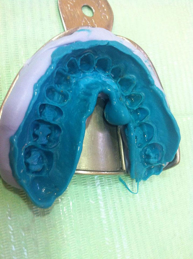 Images Punt Dental Premia