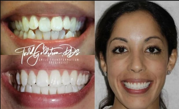 Images Todd Goldstein DDS