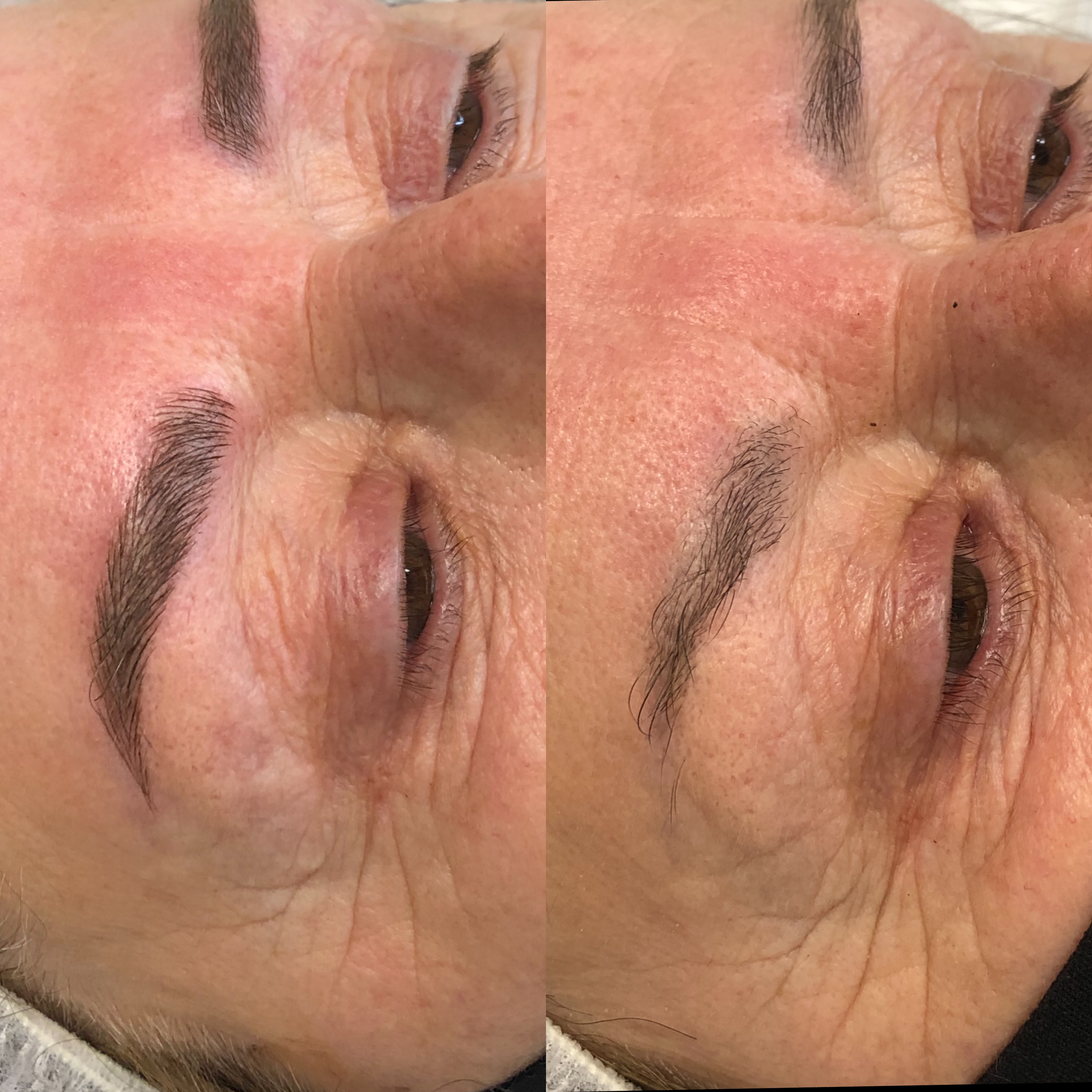 Images Clinique d'Esthétique Leila - Hydrafacial, Microblading, Épilation Laser Sainte-Foy