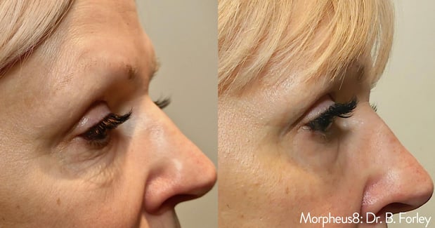 Images EliteBio: Hormone and Aesthetic Solutions