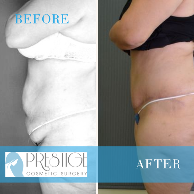 Images Prestige Cosmetic Surgery