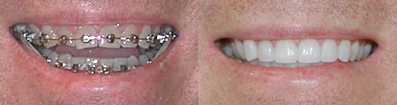 Images Premier Dental of South Orange County