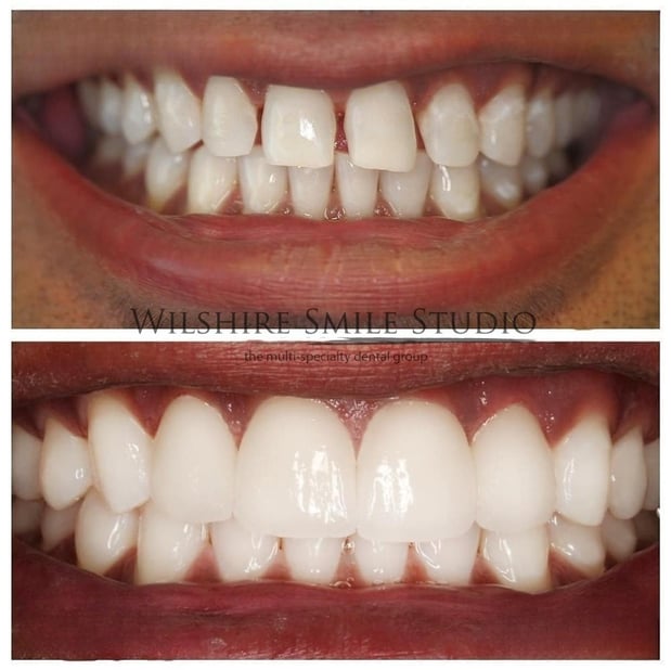 Images Wilshire Smile Studio - Los Angeles Dentist, Cosmetic and Emergency Dentistry