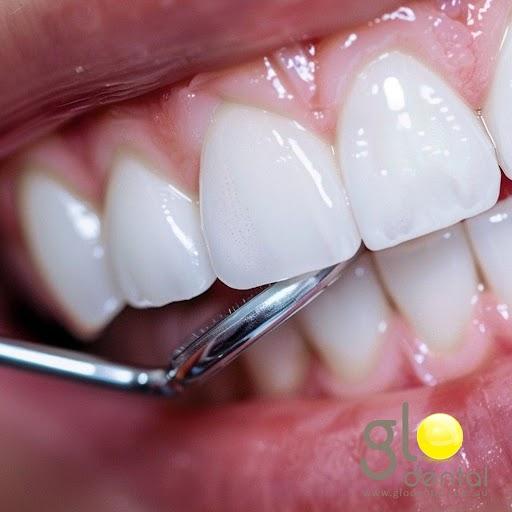 Images Glo Dental Beeliar