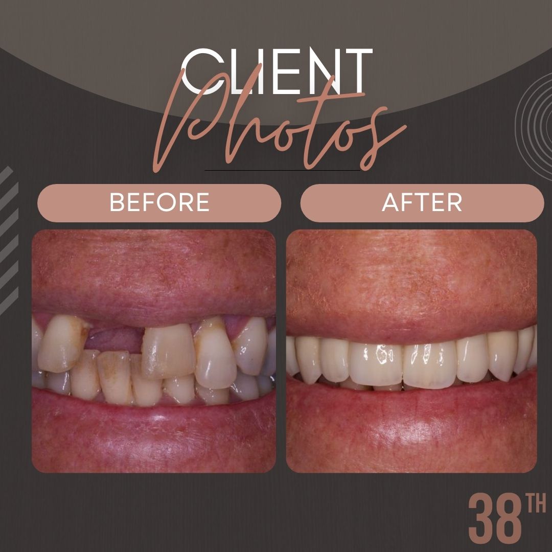 38th Street Dental | Austin, TX